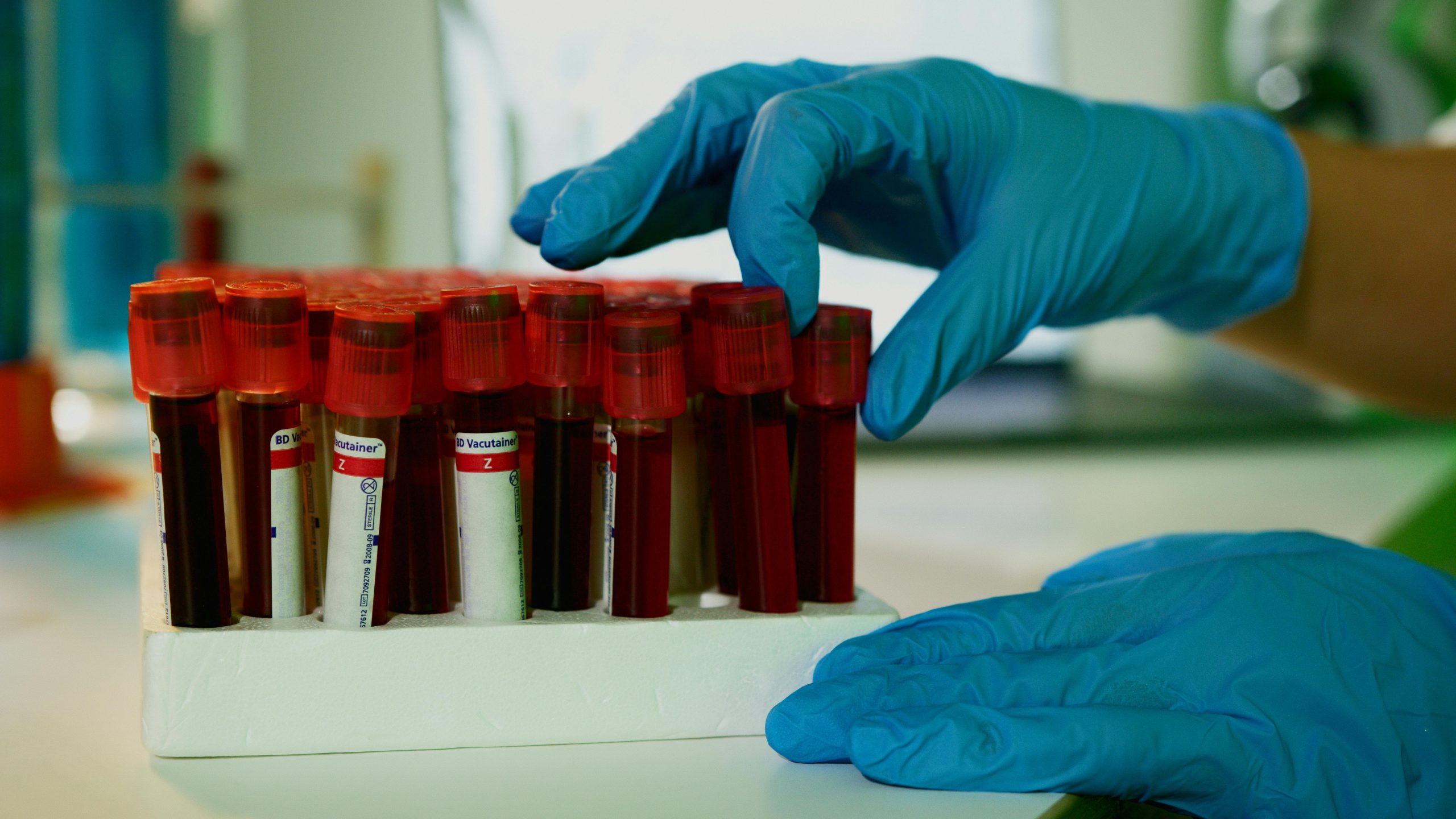 Transforming chronic disease research through digital and decentralized clinical trial solutions